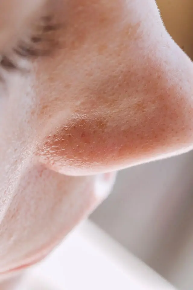 Skin-Anatomy Pores